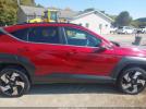 Hyundai KONA Limited Image 12