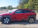Hyundai KONA Limited Image 13